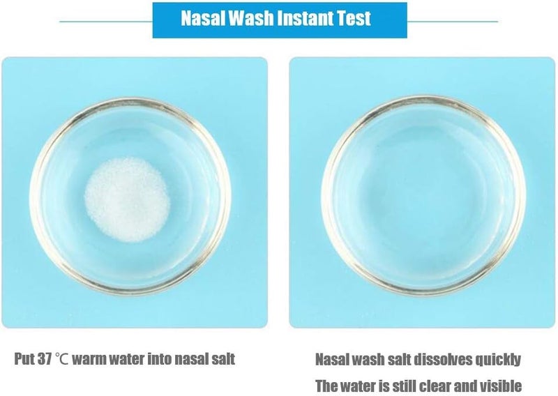 ويوبلز غسول أنفي ملحي لتخفيف التهاب الأنف التحسسي، واقي لتجويف الأنف، 40 قطعة، مناسب للبالغين من الرجال والنساء والأطفال، منظف أنف 300 مل - Image 2