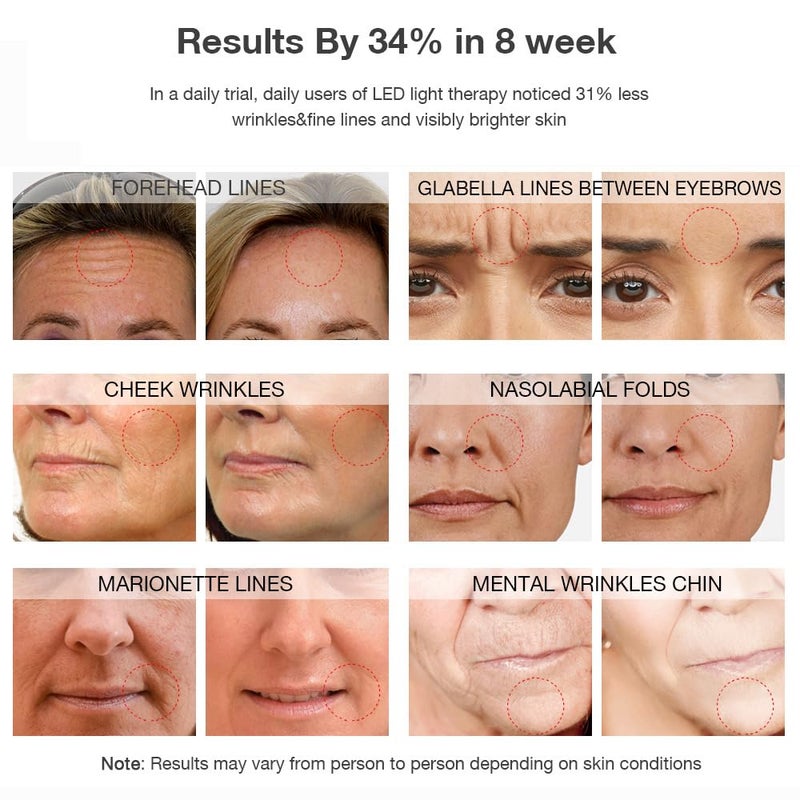 NEWKEY قناع العلاج بالضوء الأحمر NEWKEY للتجاعيد الوجه، 7 مصابيح LED للعلاج بالضوء، قناع العناية بالبشرة في المنزل لمكافحة الشيخوخة - Image 4
