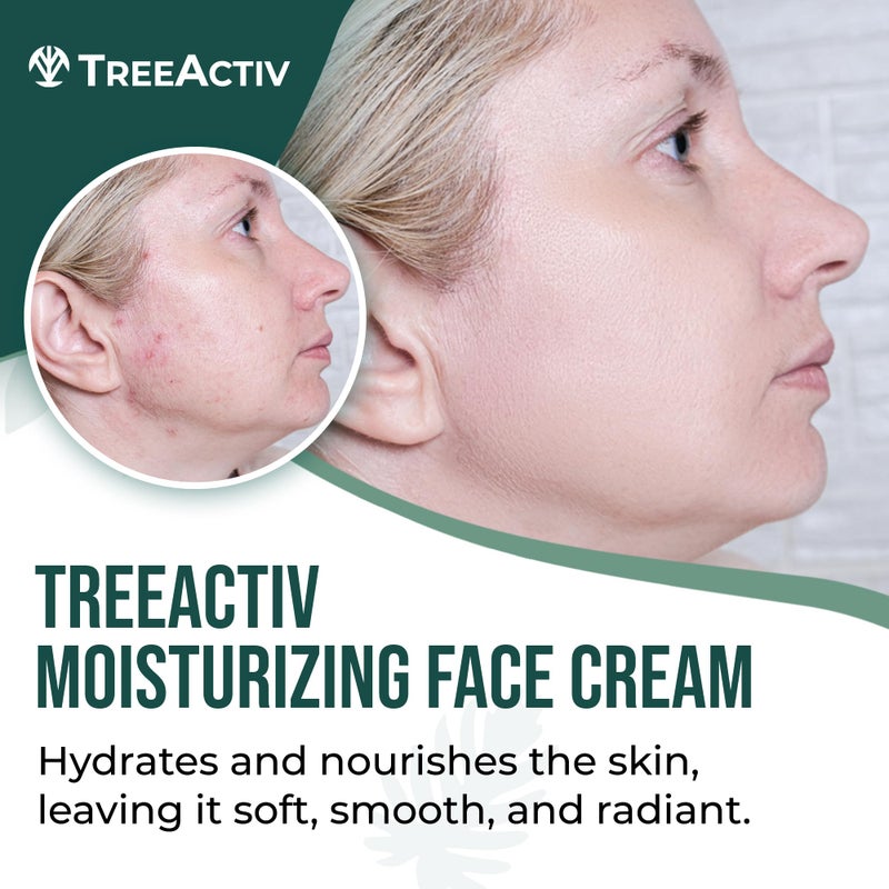 TreeActiv Acne Eliminating Face Cream | Tea Tree Moisturizing Formula for Balanced, Fresh-Looking Skin | Suitable for Sensitive Skin | For Adults and Teens | 2 fl oz - Image 2