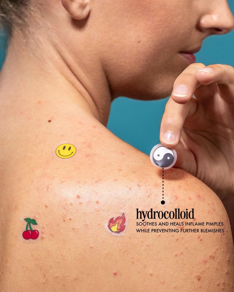 Truly Beauty Pimple Party Pack with Hydrocolloid Acne Patches - Pimple Patch Cute - Zit Patch - Pimples Patches Face - Pimple Stickers - Cute Pimple Patches - 24 CT - 12 mm - Image 3