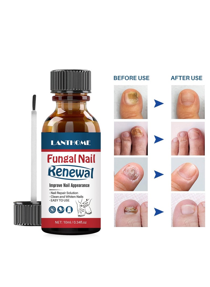 Lanthome Lian Biquan Nail Liquid Gentle Moisturizing Nail Repair Liquid 10ml Remove gray nails