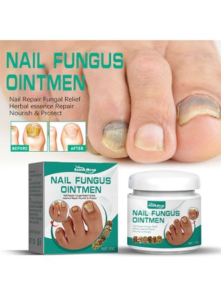 Nail Fungus Ointmen - Thickening, Brightening, and Repairing Solution for Damaged Nails on Hands and Feet - pzsku/ZAC8E306AF5A44389DEEFZ/45/_/1726668842/b5eec60d-43a3-4f70-9cc7-9524e157695c
