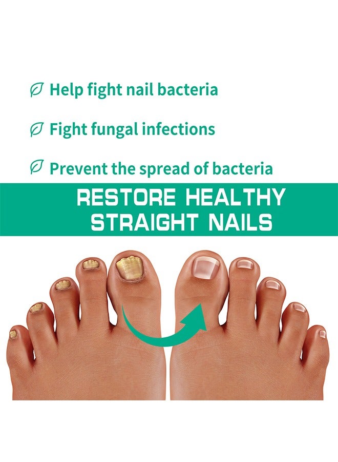 SOUTH MOON Nail Fungus Ointmen - Thickening, Brightening, and Repairing Solution for Damaged Nails on Hands and Feet - Image 3