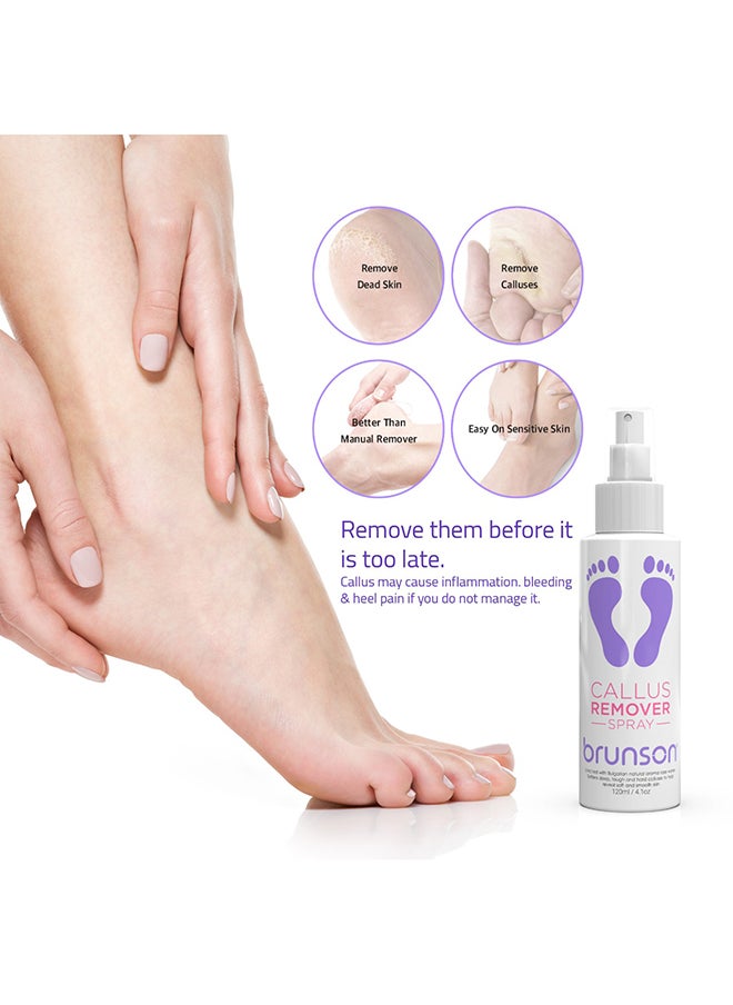 brunson - Foot Callus Softener, Callus Remover Spray Moisturizing Foot Care Gel Dead Skin Horniness Removal BCR120 - Image 1