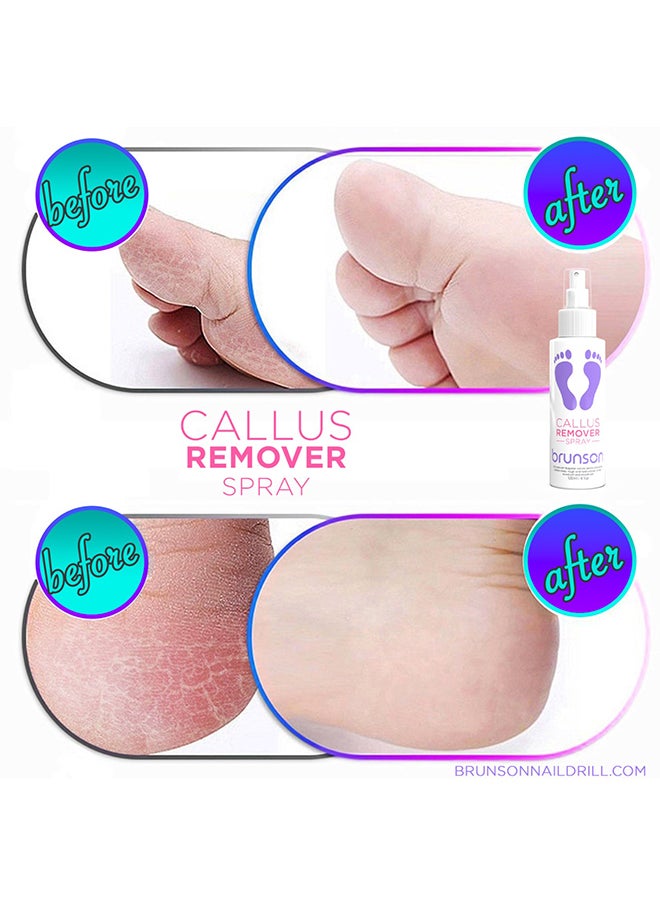 brunson - Foot Callus Softener, Callus Remover Spray Moisturizing Foot Care Gel Dead Skin Horniness Removal BCR120 - Image 1