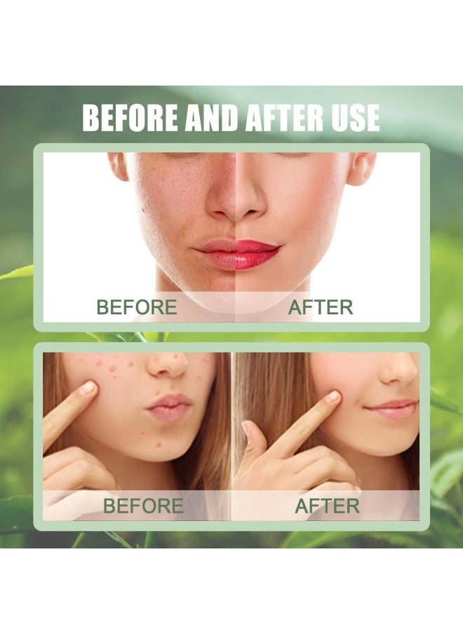 Generic - Deep Cleanse Green Tea Mask, Poreless Deep Cleanse Green Tea Face Mask, Green Tea Mask Stick Blackhead Remover, Green Tea Mask Clay Stick Face Mask (4 Pcs) - Image 1