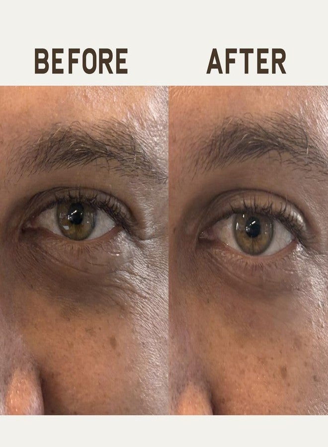 Papatui by Dwayne Johnson Fast-Acting Under Eye Patches for Men | Ageless Action to Reduce Puffiness, Dark Circles and Fine Lines | Made with Niacinamide, Hyaluronic Acid, Caffeine | 6ct - Image 4