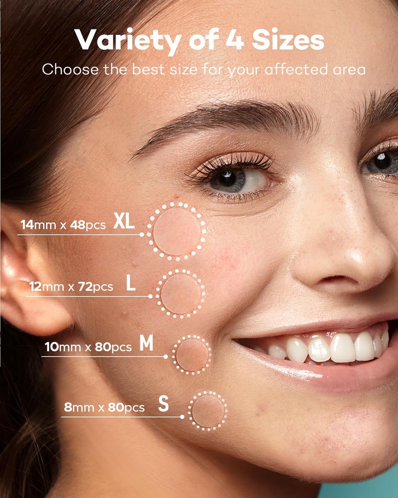 TKTK Pimple Patch Acne Patch, 4 Sizes 280 Patches Acne Absorbing Cover Patch, Hydrocolloid Invisible Acne Patches For Face Zit Patch Acne Dots Tea Tree, Calendula Oil - 2 Pack - Image 2