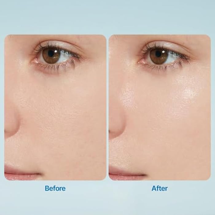 ETUDE SoonJung 2x Intensive Cream for Barrier Repair, Rich Moist, Madecassoside & Panthenol for Soothing, Face Moisturizer for Sensitive Skin, pH Balanced, Hypoallergenic, Korean Skin Care,2.02 Fl Oz - Image 4