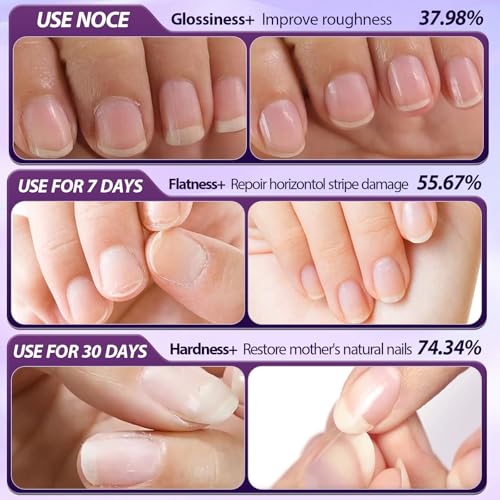 KLIFE 3Pcs Cuticle Oil Pusher Pen Set, 2-in-1 Ceramic Cuticle Pushers Pusher & Oil Pen, Nail Care Pens for Manicure & Pedicure, Hangnails, Dry & Damaged Nails - Image 3