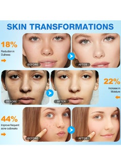 VOGSIG 40Pcs Kojic Acid and Turmeric Cleansing Pads for Dark Spots Helps Balance Skin Oil and Water Fade Spot Remove Excess Keratin Clean Oil Refines Pores Turmeric Kojic Acid Cleansing Pads  - Image 5
