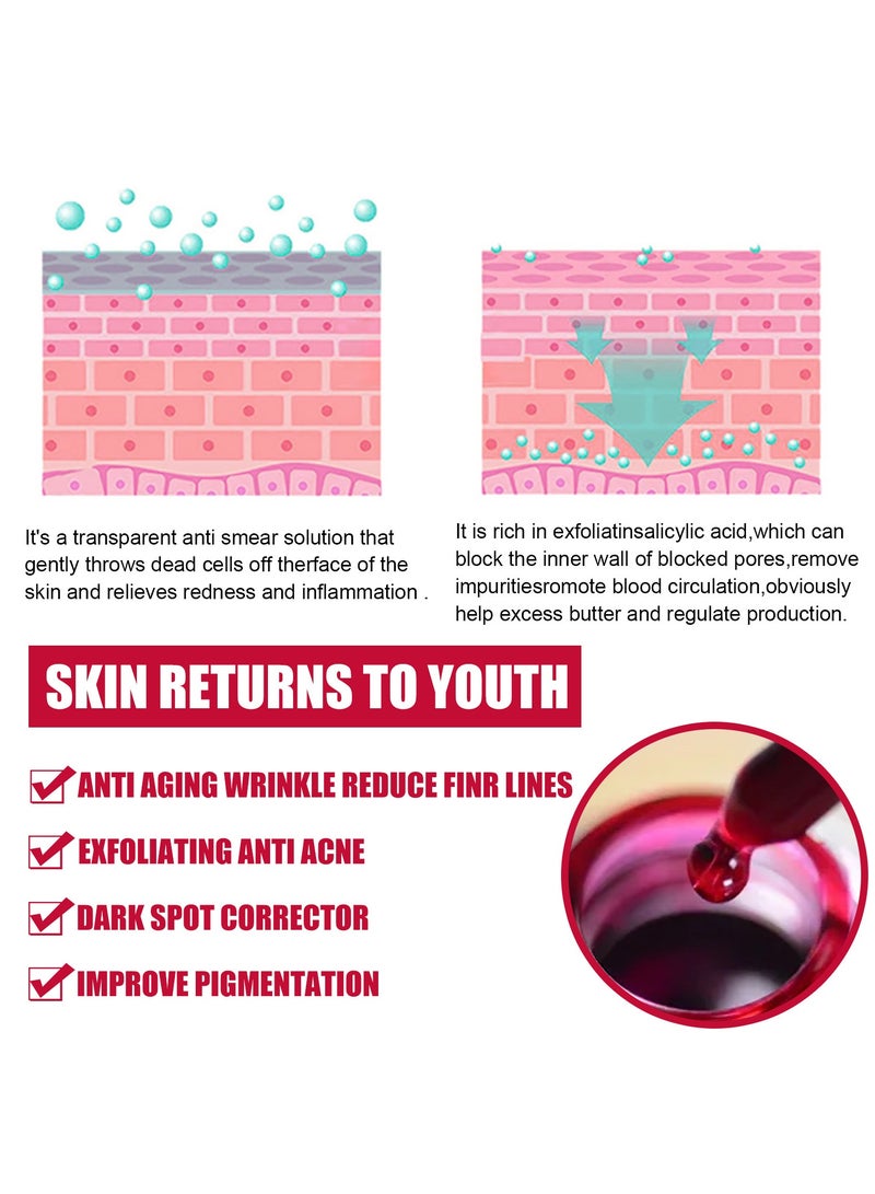 EELHOE AHA30%+BHA 2% salicylic acid essence - Image 5