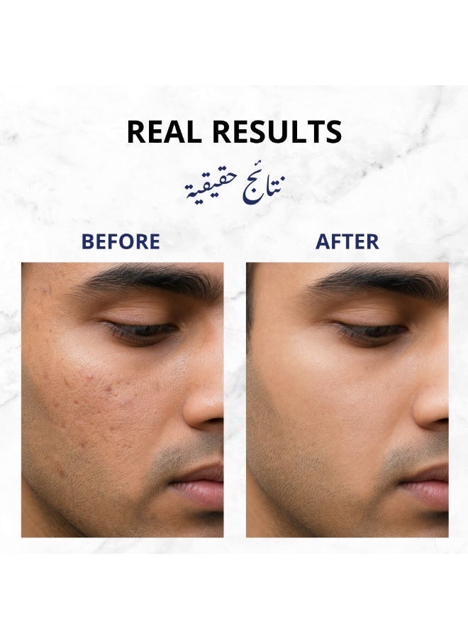 Derresthetic Tazzana - C Facewash - Image 4