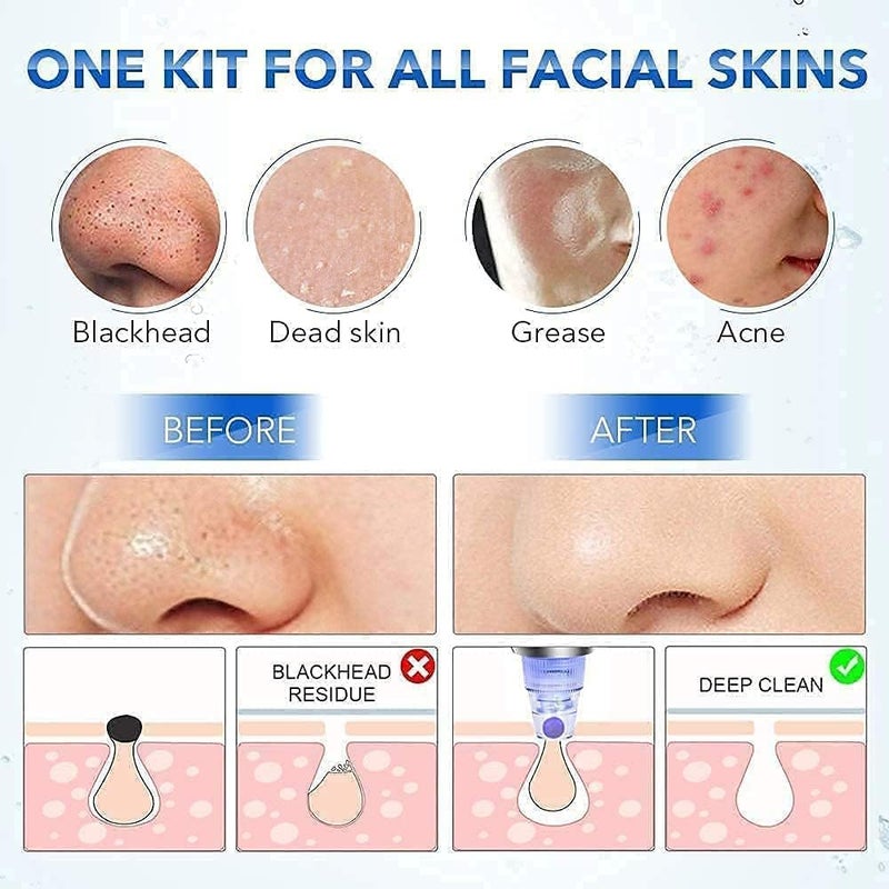 HavenFlix 4 in 1 MultiFunction Blackhead Whitehead Extractor Remover Device Skin Cleaner Pimple Removal Tool Acne Pimple Pore Cleaner Vacuum Suction Tool for Men and Women Skin Care - Image 4