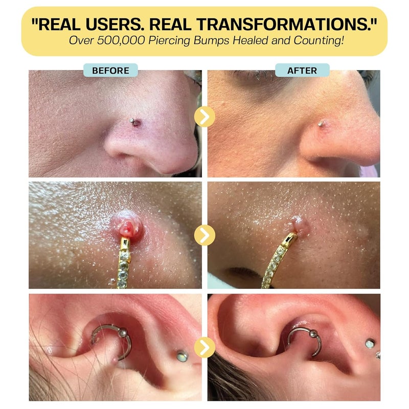 BASE LABORATORIES Piercing Keloid Bumps Shrinking Duo Piercing Bump Treatment 5oz Keloid Bump Removal Gel 2oz Keloid Scar Removal for all Scars Keloids Piercing Bumps - Image 4