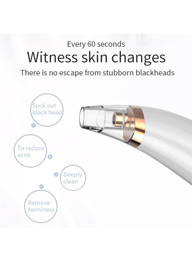 Blackhead Remover Vacuum, Pore Vacuum with 3 Replaceable Suction Probes and 1 Cartoon Hairband, Acne Comedone Blackhead Whitehead Extractor Tool, Facial Pore Cleaner - Image 3