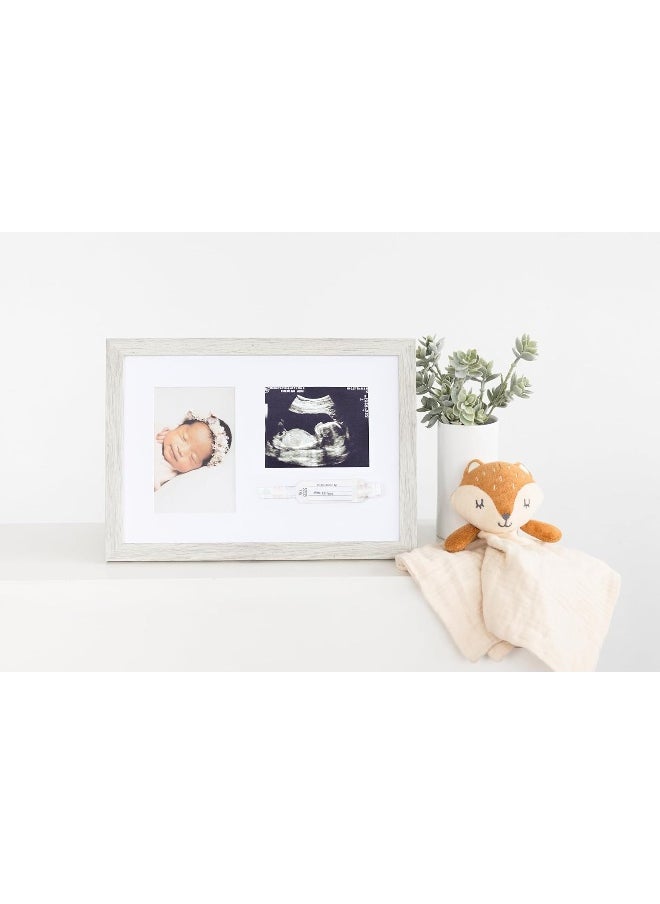 Kate & Milo - Kate & Milo Rustic Bracelet ID and Sonogram Frame, Rustic Pregnancy Keepsake Picture Frame, Gender-Neutral Nursery Décor - Image 1