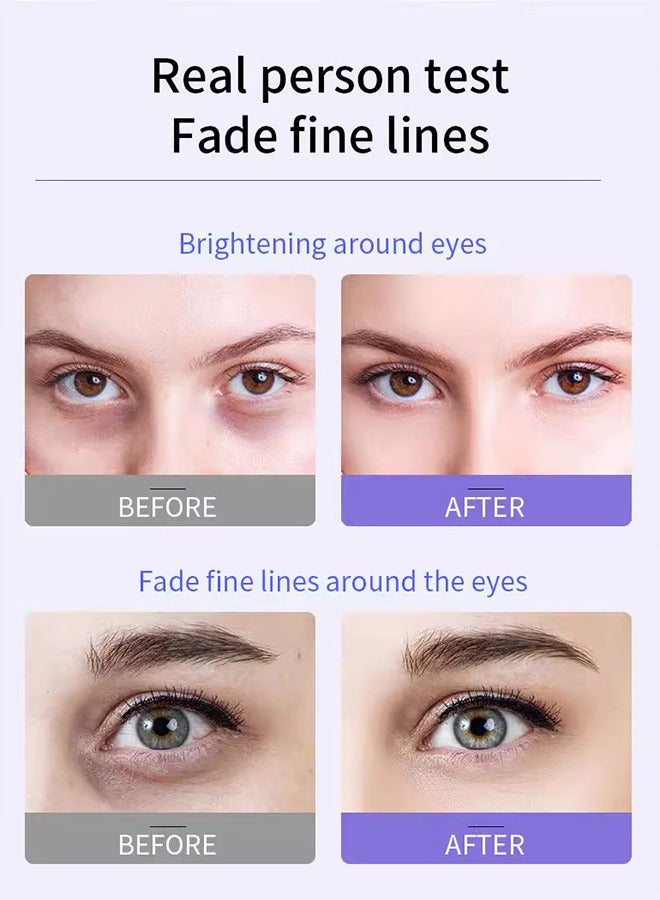 OCHEAL Eye Cream-Anti- Roller Essence Massage Eye Roller Cream for Dark Circles and Puffiness, Anti Aging, Reduce Wrinkles and Fine Lines and Eye Bags Treatment - Image 4