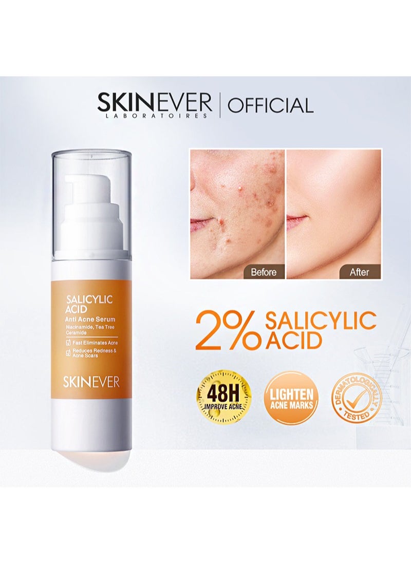 SKIN EVER - Salicylic Acid Anti Acne Serum，Contains Salicylic Acid, Niacinamide, Centella Asiatica Extract, And Ceramide To Clear Acne, Fade Acne Marks, And Repair Damaged Skin (20ml) - Image 1
