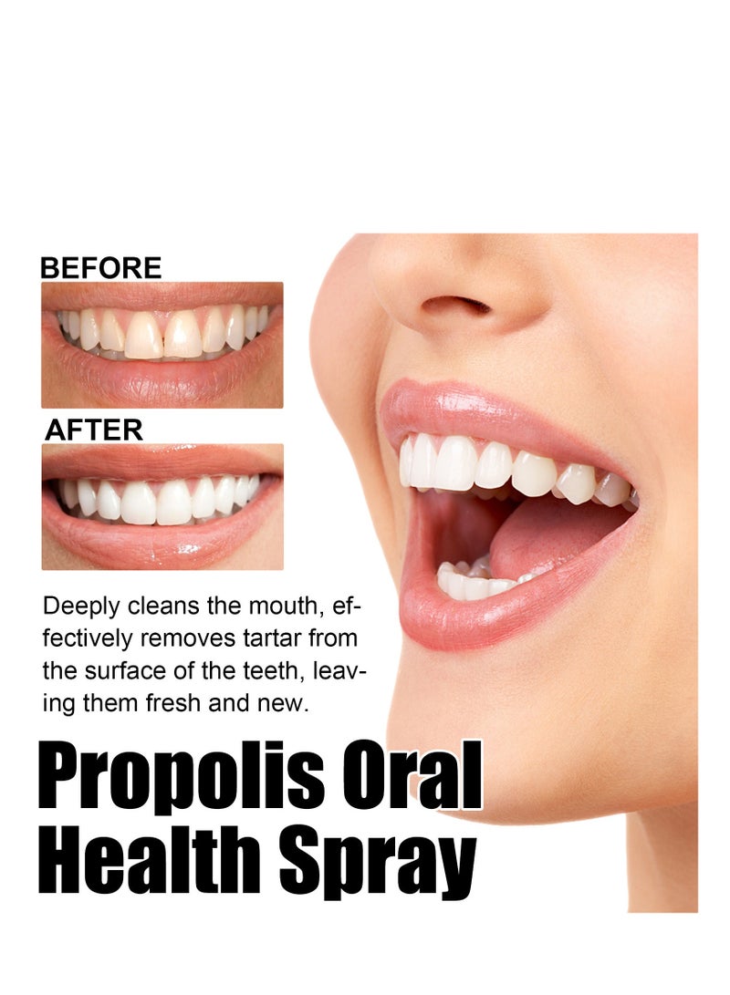 أورالحوي بخاخ صحة الفم ، بخاخ تنظيف الأسنان العميق سعة 20 مل ، بخاخ إصلاح منعش الفم ، بقع الأسنان للتنظيف العميق والجير ، مناسب لجميع مشاكل الفم - Image 4
