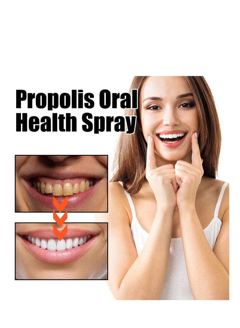أورالحوي بخاخ صحة الفم ، بخاخ تنظيف الأسنان العميق سعة 20 مل ، بخاخ إصلاح منعش الفم ، بقع الأسنان للتنظيف العميق والجير ، مناسب لجميع مشاكل الفم - Image 5