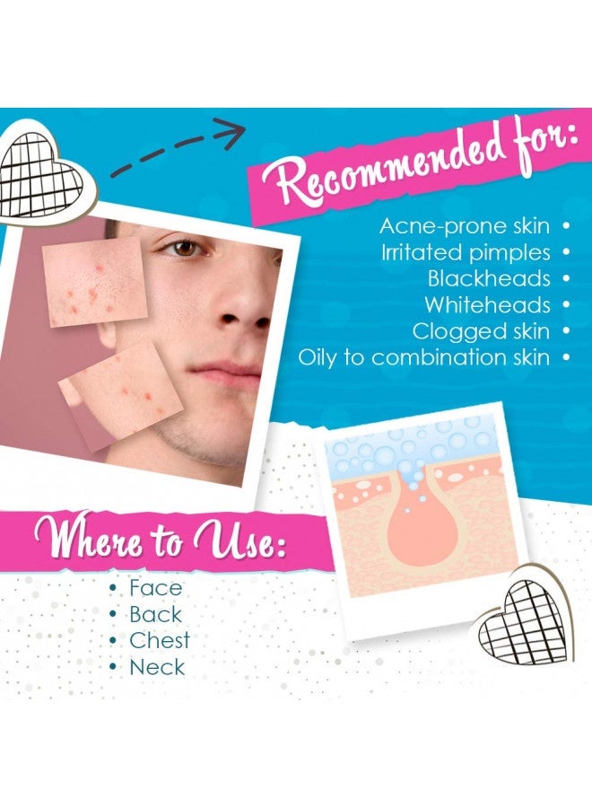 Bye Bye Blemish Acne Drying Lotion, Reduce Pimples Overnight 1Oz, 1-Pack - Image 4