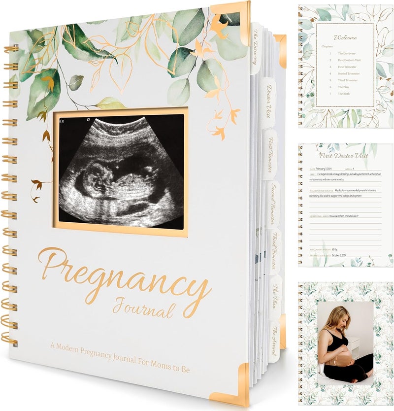 KeaBabies دفتر الحمل للأمهات الجدد هدايا 90 صفحة غلاف صلب كتاب ذاكرة الحمل كتاب جميل لطيف لحفظ الذكريات ألبوم صور الموجات فوق الصوتية هدية للأم الحامل - Image 1