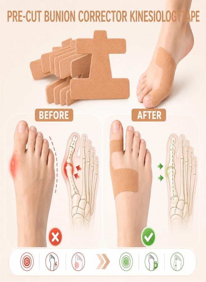 40 Pcs Pre-Cut Bunion Corrector Kinesiology Tape, Elastic Waterproof Bunion Tape for Bunion Pain Relief, Latex-Free Toe Support Strips, Self-Adhesive Hallux Valgus Corrector for All People - Image 3