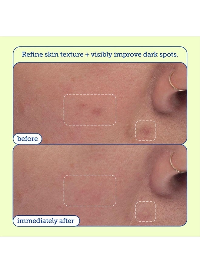 Skinfix Resurface+ AHA/BHA Niacinamide Exfoliating Pads: 2% Salicylic Acid (BHA) + AHAs & Niacinamide to Target Rough Texture, Spots, Fine Lines & Acne-Prone Skin, 60 Pads  - Image 4