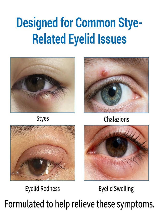 Stye Eye Treatment 2 Kits-Stye Relief Rollerball Serum & 10 Pcs Eye Patches - Image 4