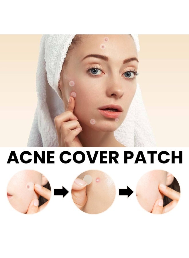 West&Month 72Pcs Hydrocolloid Acne Pimple Patch For Covering Zits And Blemishes, Spot Stickers For Face And Skin - Image 4