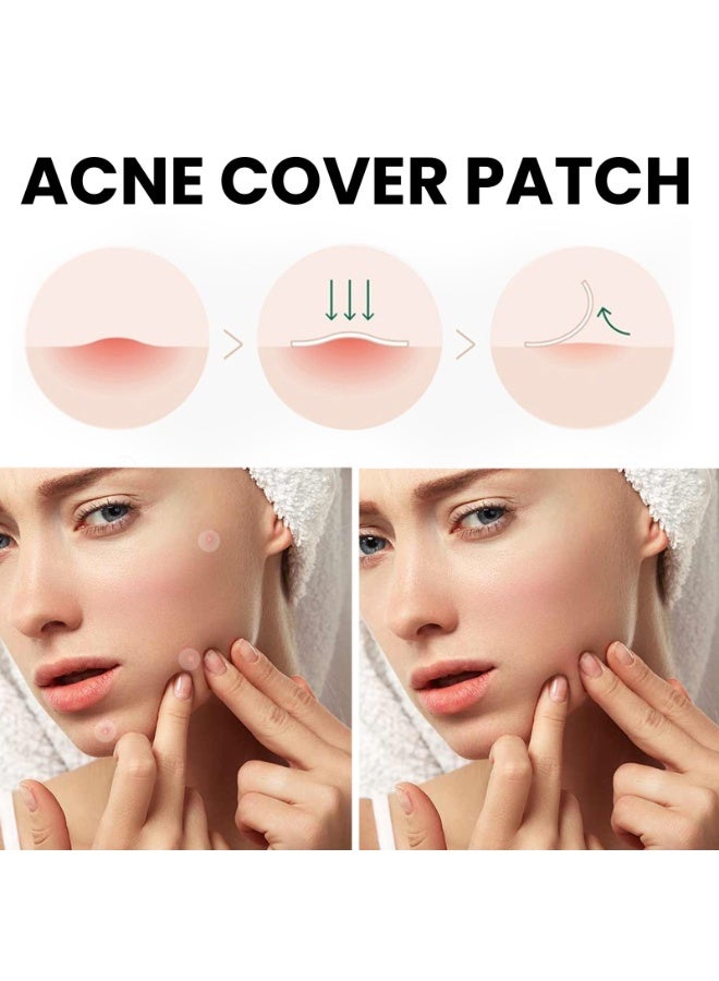 West&Month 72Pcs Hydrocolloid Acne Pimple Patch For Covering Zits And Blemishes, Spot Stickers For Face And Skin - Image 3