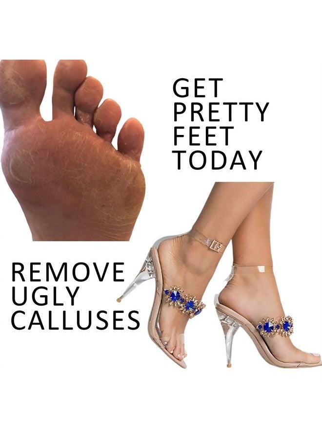 Red Bud - Foot File & Callus Remover by Red Bud, Eliminates Painful Feet Calluses, Pedicure Foot Scraper Easily Removes Dead Skin & Hard Calluses, Get Smooth Callus-Free Feet Using this Large Steel Rasp - Image 1