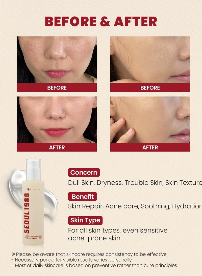 K-SECRET K-SECRET SEOUL 1988 Essence : Snail Mucin 97% + Rice, 100ml/3.38fl.oz. | 97% Snail Secretion with Rice Ferment Filtrate and Rice Extract for Skin Hydration, Soothing | Korean Skincare - Image 3
