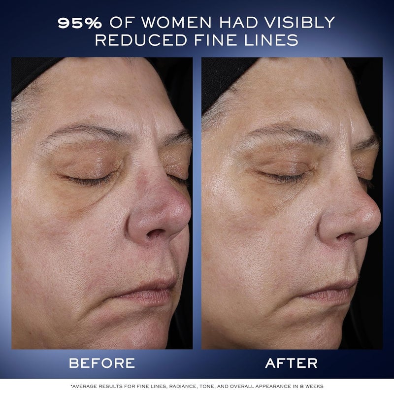 Lancme Gnifique Ultimate Dual Recovery Face Serum AntiAging Serum Visibly Improves Fine Lines Rough Texture Plumpness and Even Skintone with Beta Glucan and Hyaluronic Acid - Image 4