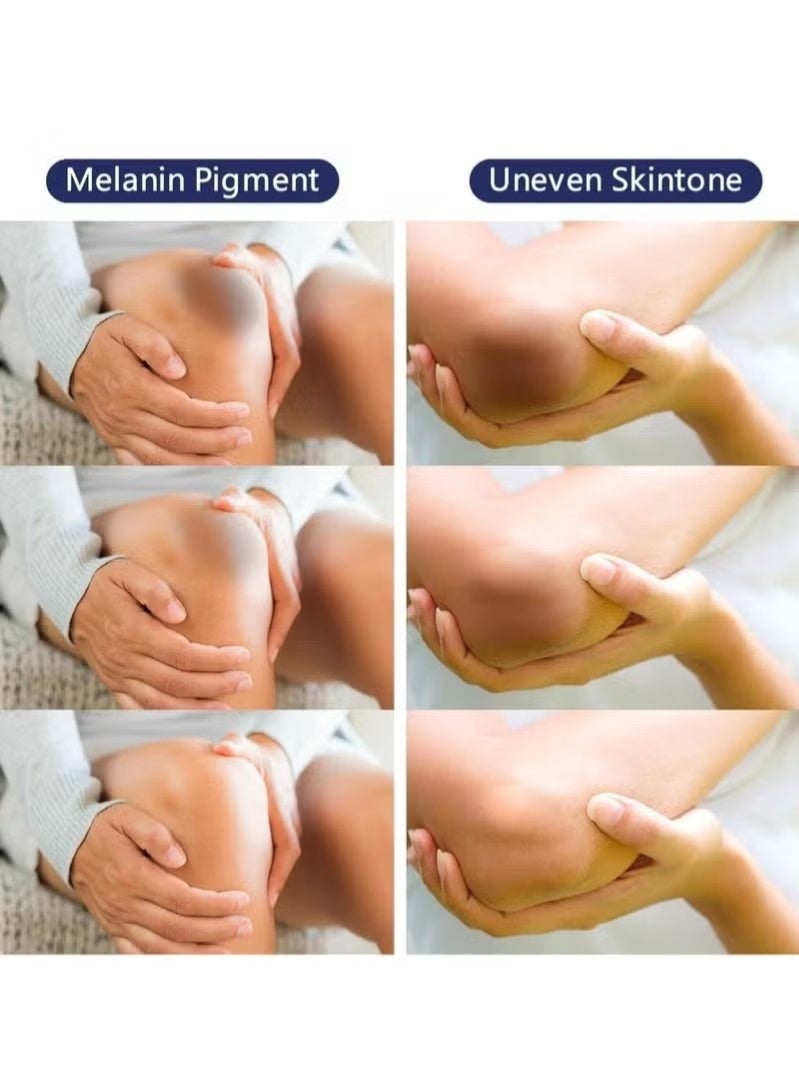 OceAura Intimate Areas Skin Lightening Cream Bleaching Cream For Body Sensitive Intimate Area, Private Parts, Underarm, Knees, Elbows, Inner Thigh, Bikini Areas, Bikini Line, Natural Skin Whitening. - Image 2