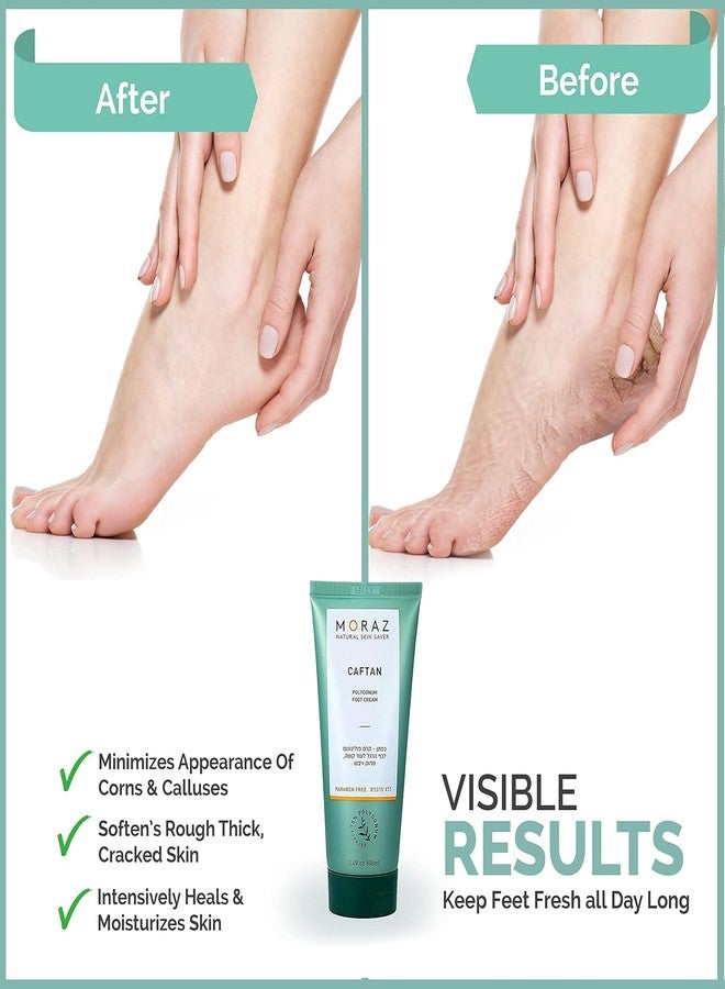 Moraz Caftan Polygonum Foot Cream for Dry Cracked Heels and Feet with 75% Polygonum Extract - Non-greasy, Fast-absorbing Intensive Foot Moisturizer for Dry Cracked Feet, Vegan, Paraben Free, 8.5 Fl Oz - Image 5