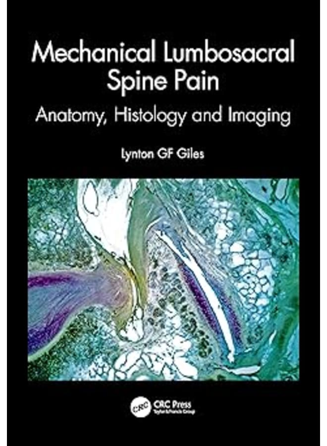Mechanical Lumbosacral Spine Pain: Anatomy, Histology and Imaging