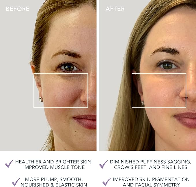 Foreo Bear Mini Targeted Microcurrent Face Lift Device Visible NonInvasive Face Lift Lavender - Image 5