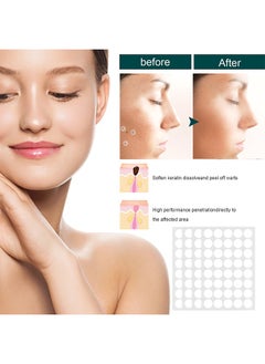 iBealee Skin Tag Patches-Mole & Wart Remover, Patch Design, Clean, Care, And Tender Skin, Painless, Easy To Use, Effective For Removing Warts, Flesh Moles, And Black Nevi, Suitable For Face And Body, Skin Label Remover 144patches  - Image 2