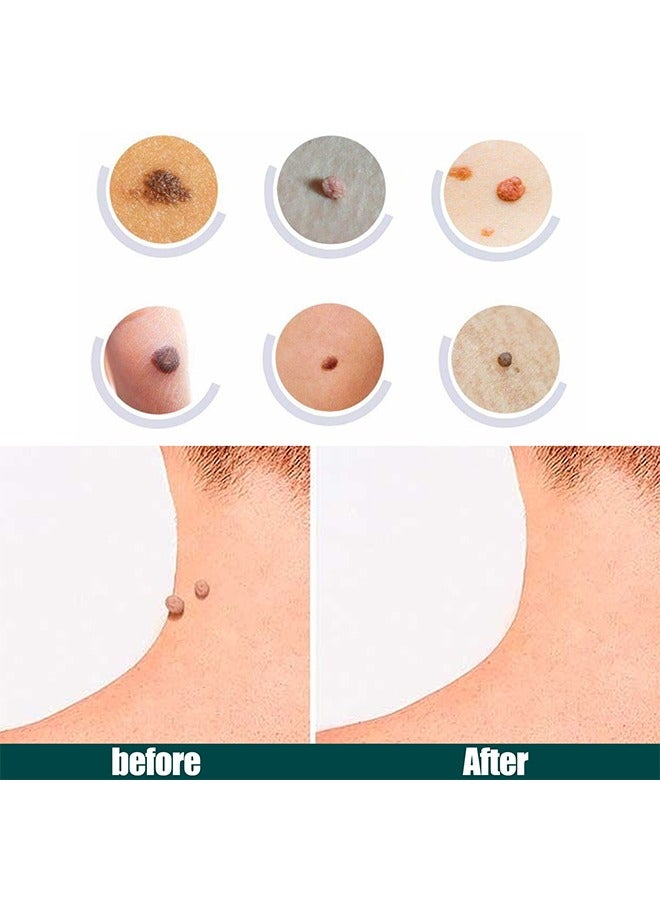 iBealee Skin Tag Patches-Mole & Wart Remover, Patch Design, Clean, Care, And Tender Skin, Painless, Easy To Use, Effective For Removing Warts, Flesh Moles, And Black Nevi, Suitable For Face And Body, Skin Label Remover 144patches - Image 5