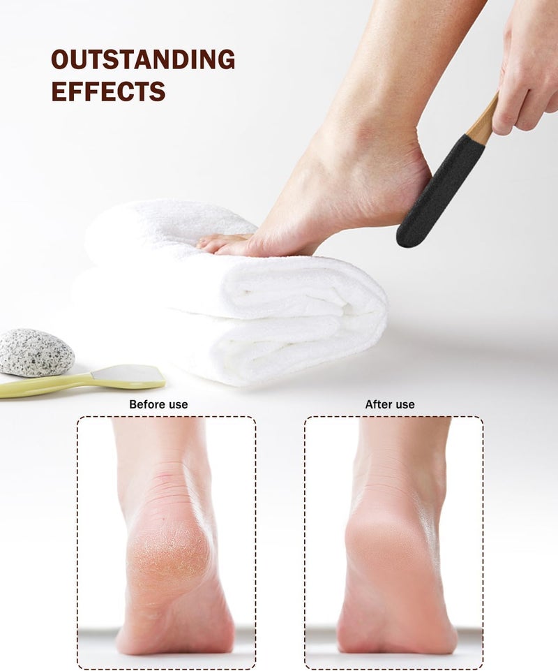Foot Pumice Stone Pedicure File(1 PCS) - Ergonomic plastic Handle Foot File Callus Remover for Smoother Feet and Hands - Foot Scrubber, Heel Sander and Dead Skin Scraper - multicolor - Image 1