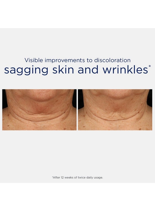 نيوستراتا كريم نيوستراتا لشد الرقبة ثلاثي المفعول، تركيبة جديدة ومحسنة - مع مايكرو دي ببتيد 229®، نيوجلوكوزامين، وباكوتشيول، خالي من العطور والزيوت، كريم تجديد منطقة الصدر لجميع أنواع البشرة، 80 جرام. - Image 4