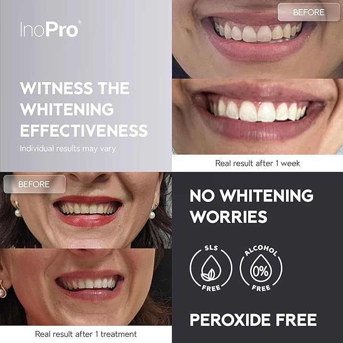 InoPro Natural Teeth Whitening Strips Kit 21 Treatments - Sensitive Teeth Whitener, Peroxide Free with Papain, Bromelain, Coconut Oil, White Strips for Teeth Whitening (42 Strips) - Image 2