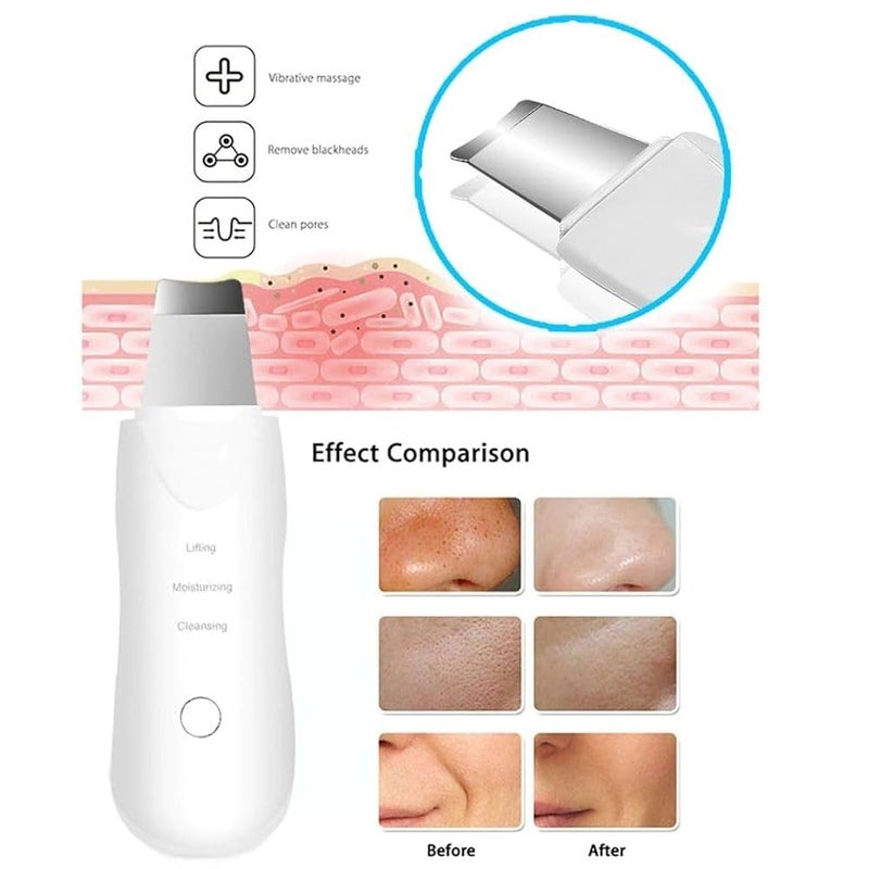 Ultrasonic Blackhead Remover Portable Facial Cleanser Rechargeable Facial Skin Cleaner Facial Skin Scrubber Exfoliator White - Image 3