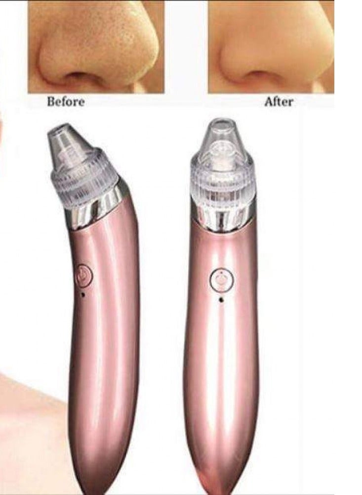 جهاز شفط الرؤوس السوداء والحبوب الكهربائي الحل الأمثل لبشرة نقية ومتألقة - Image 2