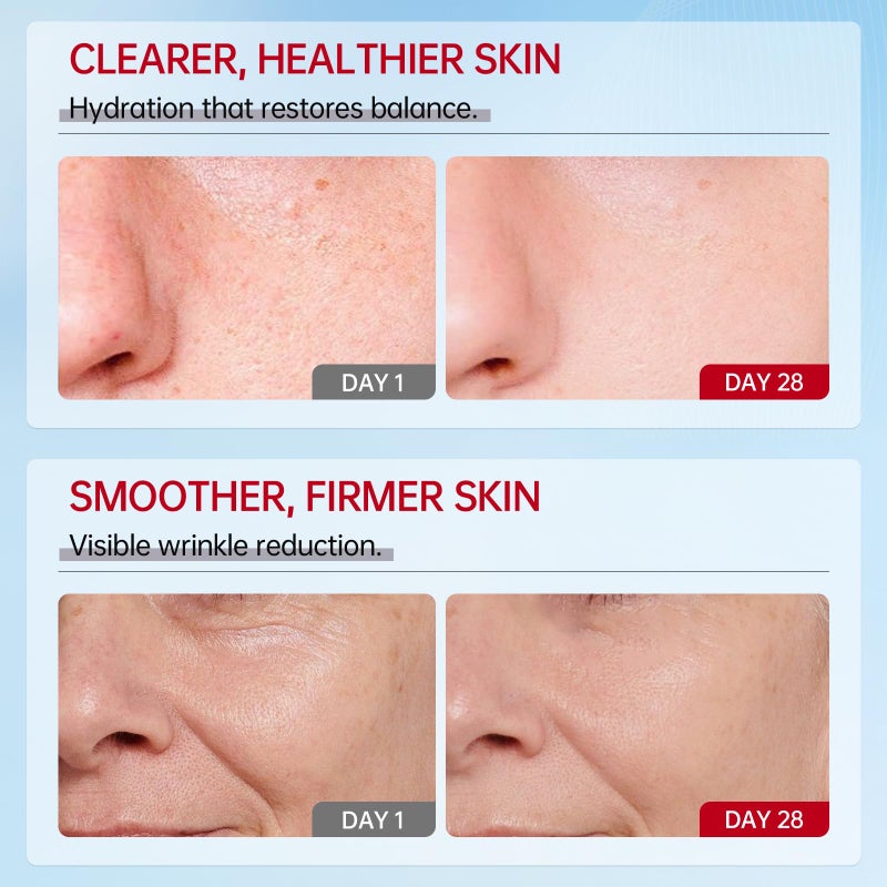 VGO مرطب فيغو بمستخلص الحلزون 92% مرطب يومي للوجه جل كريم مرطب لإصلاح البشرة للجلد الجاف والحساس، لجميع أنواع البشرة 50 جرام / 1.76 أونصة - Image 5