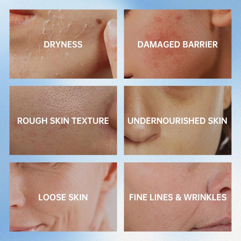 VGO مرطب فيغو بمستخلص الحلزون 92% مرطب يومي للوجه جل كريم مرطب لإصلاح البشرة للجلد الجاف والحساس، لجميع أنواع البشرة 50 جرام / 1.76 أونصة - Image 3