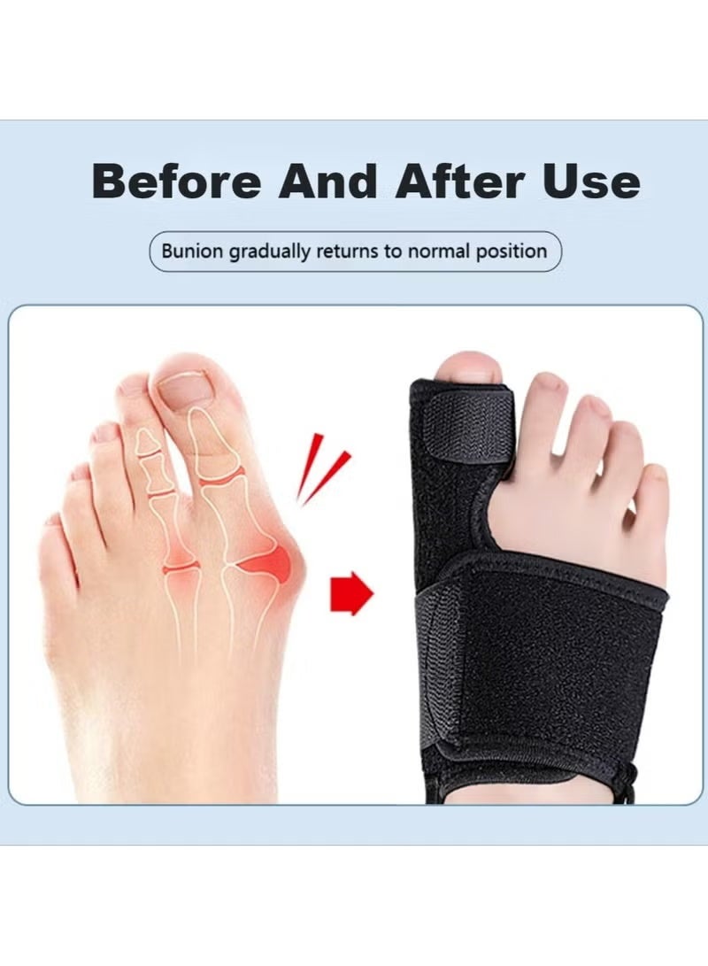 جبيرة تقويم إبهام القدم وتصحيح انحراف أصابع القدم - تخفف آلام مفصل إصبع القدم الكبير الناتجة عن انحراف إبهام القدم للخارج وانحراف إصبع القدم المطرقية، دعم قابل للتعديل بدون جراحة، ملائمة مريحة للجميع - Image 2