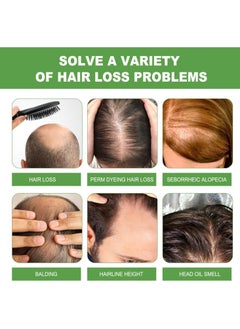 EELHOE Rosemary shampoo, rosemary water for hair, rosemary oil hair shampoo for women, hair growth shampoo against hair loss, biotin shampoo gently cleans the scalp sewing and moisturises the hair  - Image 4